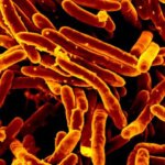 La enfermedad infecciosa que ha superado a la covid-19 y vuelve a ser la más mortal La enfermedad infecciosa que ha superado a la covid-19 y vuelve a ser la más mortal