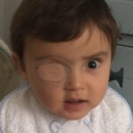 ¿Por qué a algunos niños pequeños se les tapa un ojo con un parche?