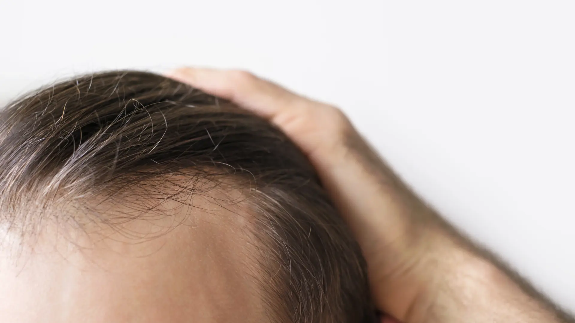 puede provocar pérdida de pelo puede provocar pérdida de pelo