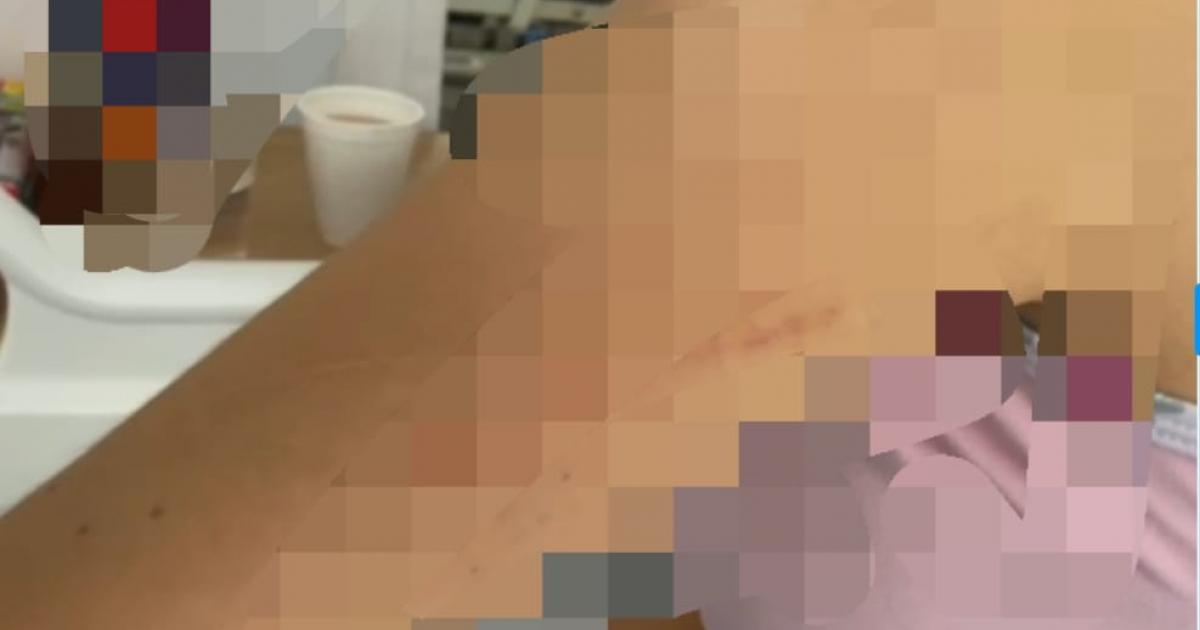 Noticias Medellín: Madre de familia habría golpeado a su hija de 17 años Noticias Medellín: Madre de familia habría golpeado a su hija de 17 años