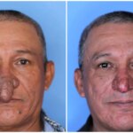 causas, síntomas, tipos y tratamientos disponibles causas, síntomas, tipos y tratamientos disponibles