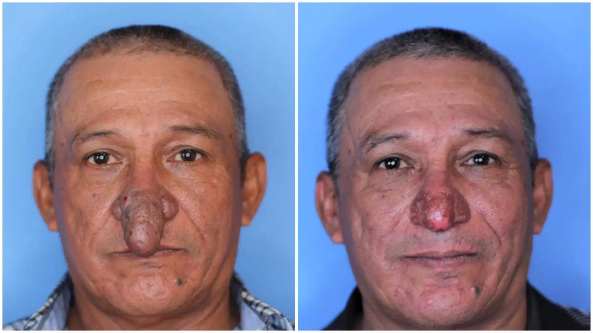 causas, síntomas, tipos y tratamientos disponibles causas, síntomas, tipos y tratamientos disponibles