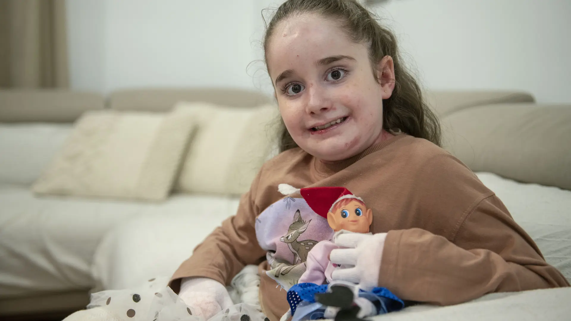 Un hilo de esperanza para Mía, la pequeña de siete años con piel de mariposa Un hilo de esperanza para Mía, la pequeña de siete años con piel de mariposa