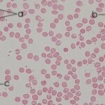 Una investigación española descubre cómo envejece la sangre y abre la puerta a métodos para revertirlo