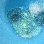 Investigadores españoles graban por primera vez la implantación de un embrión humano en tiempo real: puede mejorar la fertilidad Investigadores españoles graban por primera vez la implantación de un embrión humano en tiempo real: puede mejorar la fertilidad