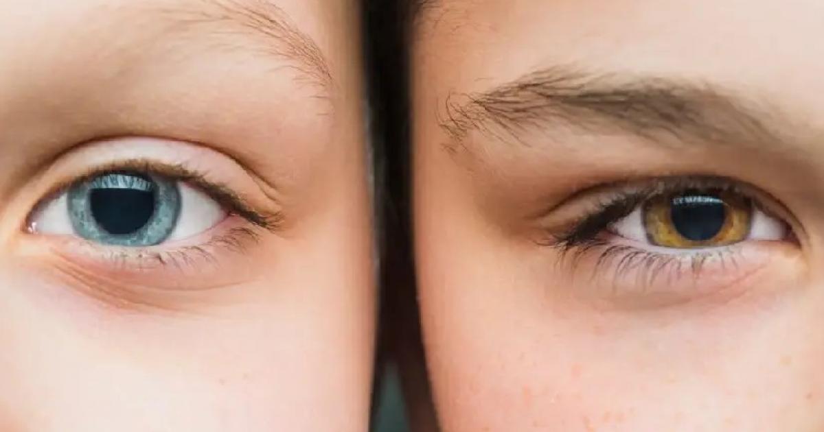Noticias Medellín: Escaneaba el iris de los ojos por dinero