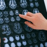 La estimulación cerebral puede impulsar a las personas a comportarse de manera menos egoísta La estimulación cerebral puede impulsar a las personas a comportarse de manera menos egoísta