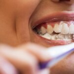 La higiene bucal rigurosa reduce la incidencia de cáncer de mama vinculado a la periodontitis La higiene bucal rigurosa reduce la incidencia de cáncer de mama vinculado a la periodontitis