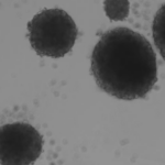 Un equipo catalán diseña un método con luz, que activa una molécula y elimina células madre del cáncer, culpables de las recaídas