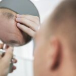 La solución contra la calvicie podría ser tan sencilla como usar un tipo de azúcar, según la investigadora Sheila MacNeil La solución contra la calvicie podría ser tan sencilla como usar un tipo de azúcar, según la investigadora Sheila MacNeil