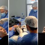 El trasplante capilar que busca devolverle el cabello a una joven que se quemó la cabeza con aceite a los dos años