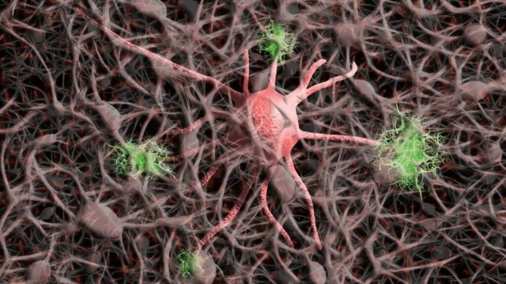 Un compuesto natural obtiene resultados prometedores contra la ataxia de Friedreich, una enfermedad neurodegenerativa rara Un compuesto natural obtiene resultados prometedores contra la ataxia de Friedreich, una enfermedad neurodegenerativa rara