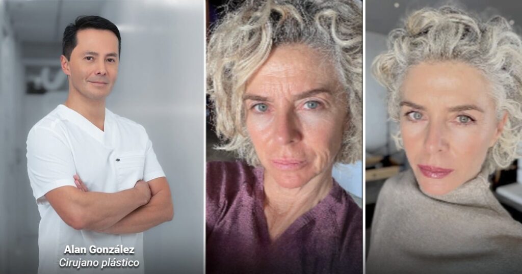 Un cirujano bogotano rejuveneció a Margarita Rosa de Francisco y que también a Miguel Varoni