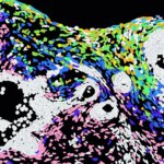 La ciencia descifra cómo se va extendiendo el herpes por la piel La ciencia descifra cómo se va extendiendo el herpes por la piel