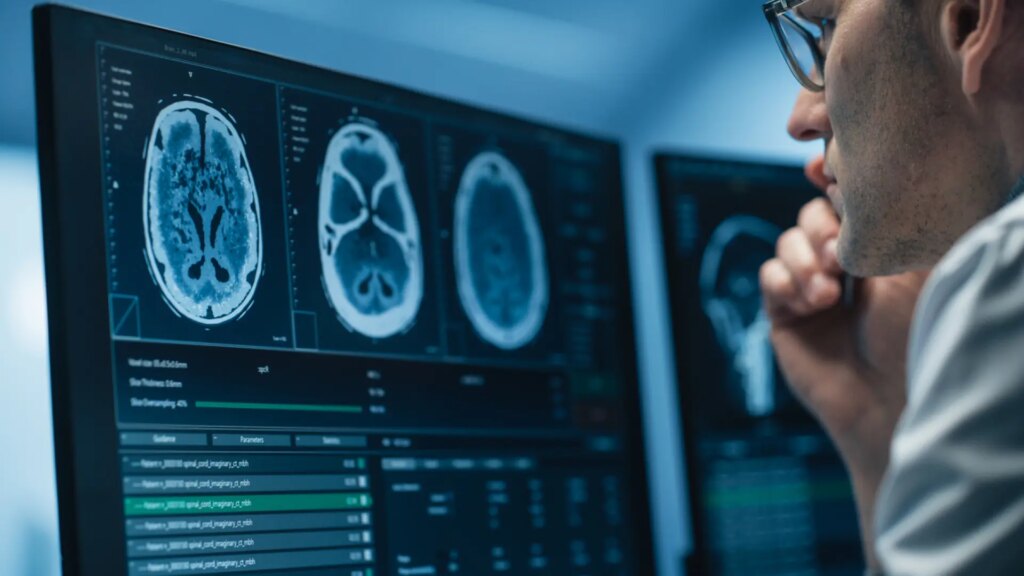 Un nuevo tratamiento logra controlar el tumor en el 96% de pacientes con un tipo de glioma cerebral
